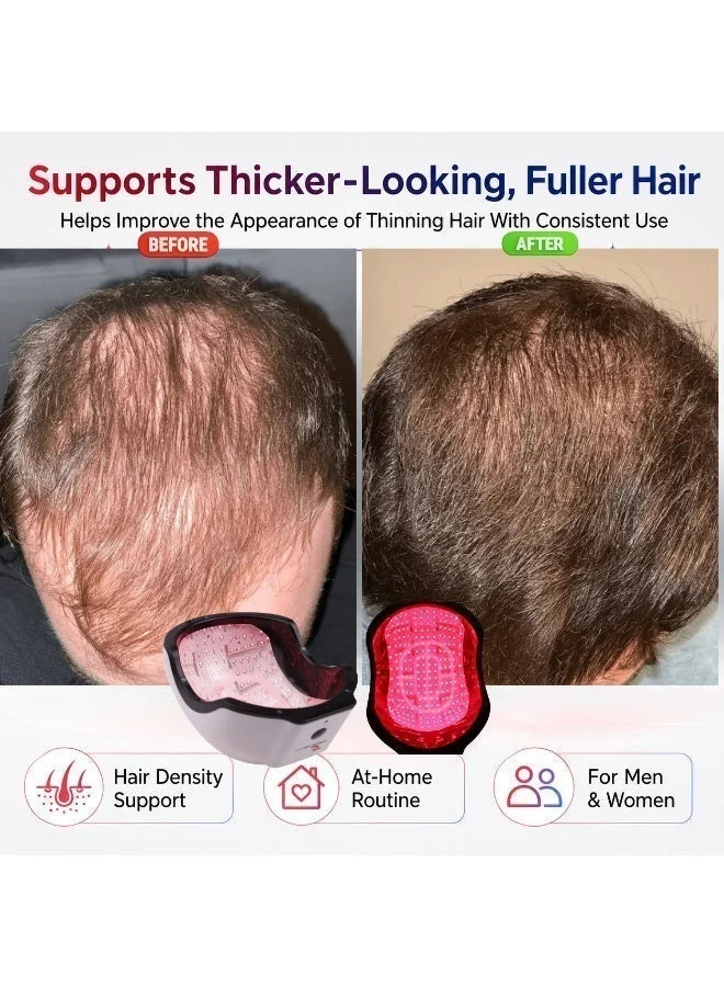 ATTRACTIVE GT Laser Hair Care Helmet RL272 PRO for Men and Women (Volumizing Scalp Therapy Device, Rechargeable, 1 Unit) xz554